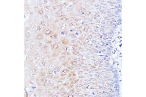 Immunohistochemistry (IHC) image for anti-Poly(A) Binding Protein, Cytoplasmic 1 (PABPC1) (AA 350-450) antibody (ABIN7269446)