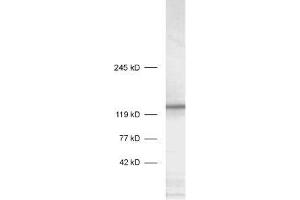 dilution: 1 : 1000, sample: crude synaptosomal fraction of rat brain (P2) (STXBP5 抗体  (AA 1031-1103))