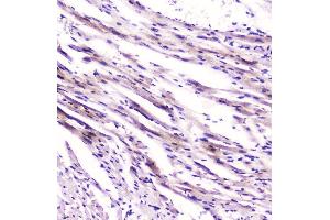 IHC analysis of Cardiac FABP using anti-Cardiac FABP antibody (ABIN5693025).