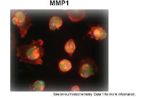 Sample Type: Human Macrophange CellsGreen: primaryRed: phallodinBlue: DAPIYellow: green/redPrimary Dilution: 1:200Secondary Antibody: anti-Rabbit IgG-FITCSecondary Dilution: 1:1000Image Submitted By: Milan FialaUniversity of California, Los Angeles (MMP1 抗体  (N-Term))