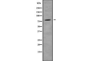 Western blot analysis IL31R using HepG2 whole cell lysates (IL31RA 抗体  (Internal Region))