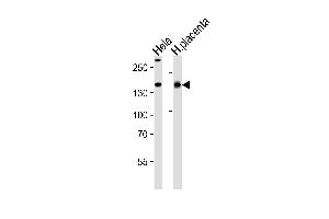 Western blot analysis of lysates from Hela cell line and human placenta tissue lysate(from left to right), using COL4A1 Antibody (N-term) A. (COL4A1 抗体  (N-Term))