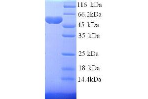 Hexokinase 1 Protein (HK1) (AA 1-485) (His tag)