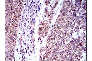 Immunohistochemistry (IHC) image for anti-Interleukin 2 Receptor, alpha (IL2RA) (AA 34-139) antibody (ABIN1845343)