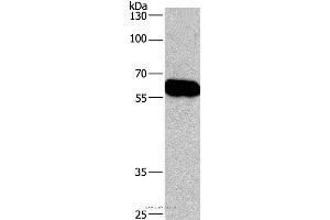 Western blot analysis of Lovo cell , using CORO1C Polyclonal Antibody at dilution of 1:670