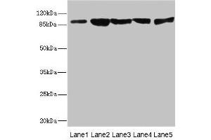 Western blot All lanes: DSC2 antibody at 3. (Desmocollin 2 抗体  (AA 520-690))