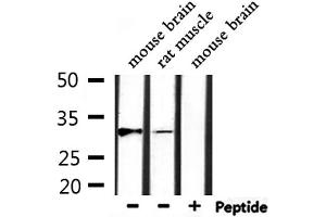 Western blot analysis of extracts from rat muscle, mouse brain, using MARCH1 Antibody. (MARCH1 抗体  (C-Term))