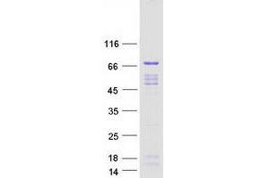 Validation with Western Blot