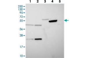 Western blot analysis of Lane 1: RT-4, Lane 2: U-251 MG, Lane 3: Human Plasma, Lane 4: Liver, Lane 5: Tonsil with TIGD6 polyclonal antibody  at 1:250-1:500 dilution. (TIGD6 抗体)
