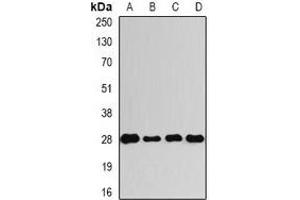Western blot analysis of VENTX expression in A549 (A), HepG2 (B), mouse spinal cord (C), rat bone marrow (D) whole cell lysates. (VENTX 抗体)