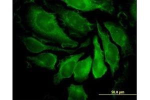 Image no. 4 for anti-P21-Activated Kinase 1 (PAK1) (AA 191-280) antibody (ABIN598852) (PAK1 抗体  (AA 191-280))