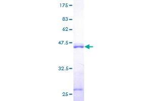 Image no. 1 for Calmodulin 2 (phosphorylase Kinase, Delta) (Calm2) (AA 1-149) protein (GST tag) (ABIN1347887) (Calmodulin 2 Protein (AA 1-149) (GST tag))