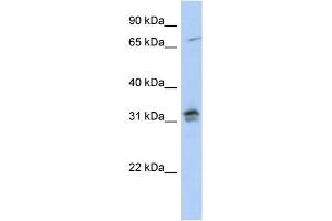 WB Suggested Anti-H1FOO Antibody Titration: 0. (H1FOO 抗体  (N-Term))