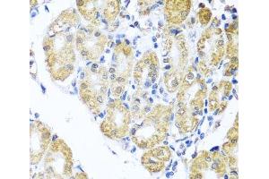 Immunohistochemistry of paraffin-embedded Human stomach using BNIP3L Polyclonal Antibody at dilution of 1:100 (40x lens). (BNIP3L/NIX 抗体)