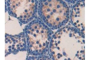 Immunohistochemistry (IHC) image for anti-Paraoxonase 2 (PON2) (AA 4-289) antibody (ABIN7440995)