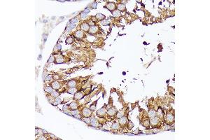 Immunohistochemistry of paraffin-embedded rat testis using Nectin 2/CD112 Rabbit mAb (ABIN7269432) at dilution of 1:100 (40x lens). (PVRL2 抗体)