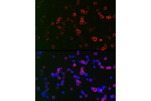 Immunofluorescence analysis of Raji cells using CD22 Rabbit pAb (ABIN6131253, ABIN6138143, ABIN6138144 and ABIN6221471) at dilution of 1:150 (40x lens). (CD22 抗体  (AA 708-847))