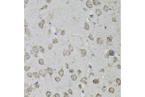 Immunohistochemistry of paraffin-embedded mouse brain using TRPC3 antibody (ABIN5995383) (40x lens). (TRPC3 抗体)