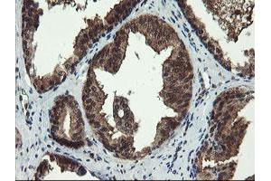 Image no. 5 for anti-Tubulin Folding Cofactor C (TBCC) antibody (ABIN1501323)