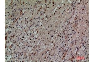 Immunohistochemical analysis of paraffin-embedded human-brain, antibody was diluted at 1:100. (CD58 抗体  (Internal Region))