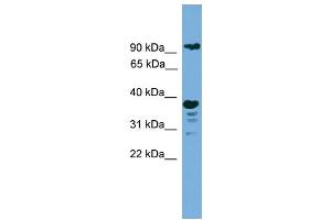 WB Suggested Anti-LAMP1  Antibody Titration: 0. (LAMP1 抗体  (N-Term))