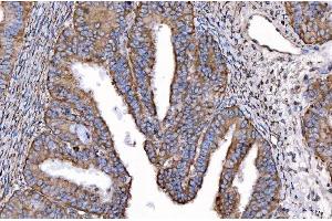 IHC analysis of HGS using anti-HGS antibody (ABIN7601206).
