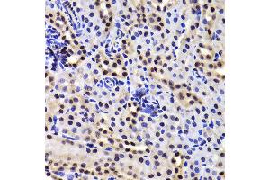 Immunohistochemistry of paraffin-embedded Mouse kidney using GABPB1 antibody at dilution of 1:100 (x400 lens). (GABPB1 抗体)