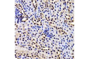 Immunohistochemistry of paraffin-embedded Mouse kidney using GABPB1 antibody at dilution of 1:100 (x400 lens).