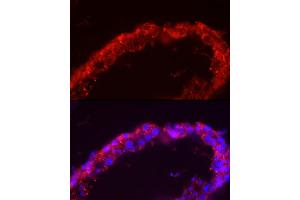 Immunofluorescence analysis of human testis cells using SP Rabbit pAb (ABIN3022967, ABIN3022968, ABIN1513554 and ABIN6219322) at dilution of 1:150 (40x lens). (SPAM1 抗体  (AA 100-300))