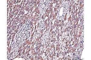 IHC analysis of Alpha 2 Antiplasmin/SERPINF2 using anti-Alpha 2 Antiplasmin/SERPINF2 antibody (ABIN7601808). (alpha 2 Antiplasmin 抗体  (AA 461-491))