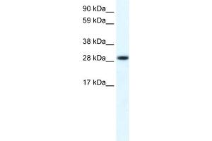 WB Suggested Anti-FHL1 Antibody Titration:  0. (FHL1 抗体  (C-Term))