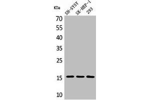 Western Blot analysis of SH-SY5Y 293 SK-HEP-1 cells using Phospho-Synuclein-α (Y125) Polyclonal Antibody (SNCA 抗体  (pTyr125))