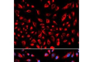 Immunofluorescence analysis of U2OS cells using CLDN11 Polyclonal Antibody (Claudin 11 抗体)