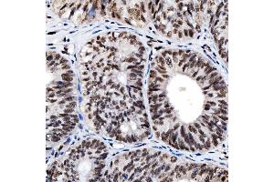 IHC analysis of SNRNP200 using anti-SNRNP200 antibody (ABIN7602032). (SNRNP200 抗体  (AA 557-2129))