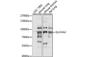 Western blot analysis of extracts of various cell lines, using SLC44A2 antibody (ABIN6291931) at 1:1000 dilution. (SLC44A2 抗体)