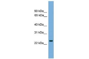 WB Suggested Anti-FEV Antibody Titration: 0. (FEV 抗体  (N-Term))