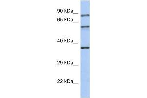 WB Suggested Anti-RPH3A Antibody Titration:  0. (RPH3A 抗体  (N-Term))