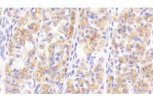 Detection of CK13 in Human Stomach Tissue using Polyclonal Antibody to Cytokeratin 13 (CK13) (Cytokeratin 13 抗体  (AA 104-403))
