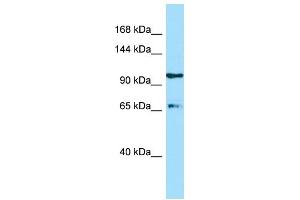 WB Suggested Anti-ESF1 Antibody Titration: 1. (ESF1 抗体  (C-Term))