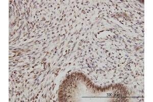 Immunostaining (ISt) image for anti-Proteasome (Prosome, Macropain) Subunit, beta Type 2 (PSMB2) (AA 1-201) antibody (ABIN562476)