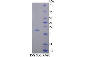 SDS-PAGE of Protein Standard from the Kit (Highly purified E. (MMP13 CLIA Kit)