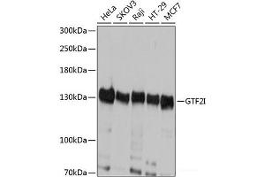 Western blot analysis of extracts of various cell lines using GTF2I Polyclonal Antibody at dilution of 1:1000. (GTF2I 抗体)