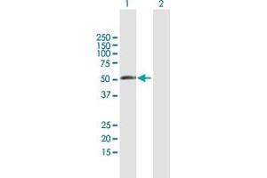 Western Blot analysis of RBM23 expression in transfected 293T cell line by RBM23 MaxPab polyclonal antibody. (RBM23 抗体  (AA 1-424))