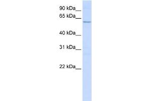 WB Suggested Anti-NETO2 Antibody Titration:  0. (NETO2 抗体  (N-Term))