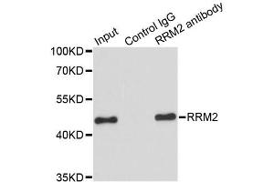 Immunoprecipitation analysis of 200 μg extracts of HeLa cells using 1 μg RRM2 antibody (ABIN5973030). (RRM2 抗体)