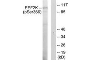 Western blot analysis of extracts from HeLa cells treated with serum 10 % 15', using eEF2K (Phospho-Ser366) Antibody. (EEF2K 抗体  (pSer366))