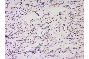 Formalin-fixed and paraffin embedded rat brain labeled with Anti-NSD1 Polyclonal Antibody, Unconjugated  at 1:200 followed by conjugation to the secondary antibody and DAB staining. (NSD1 抗体  (AA 2401-2600))