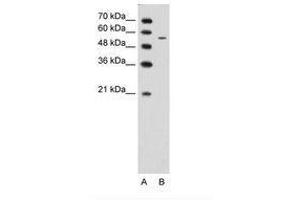 Image no. 1 for anti-Carbohydrate (N-Acetylglucosamine 6-O) Sulfotransferase 7 (CHST7) (AA 256-305) antibody (ABIN203380) (CHST7 抗体  (AA 256-305))