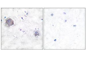 Immunohistochemistry (IHC) image for anti-Notch 1 (NOTCH1) (Cleaved-Val1754), (Internal Region) antibody (ABIN1853472) (Notch1 抗体  (Cleaved-Val1754, Internal Region))