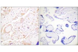 Immunohistochemistry analysis of paraffin-embedded human placenta tissue using GATA3 antibody. (GATA3 抗体)